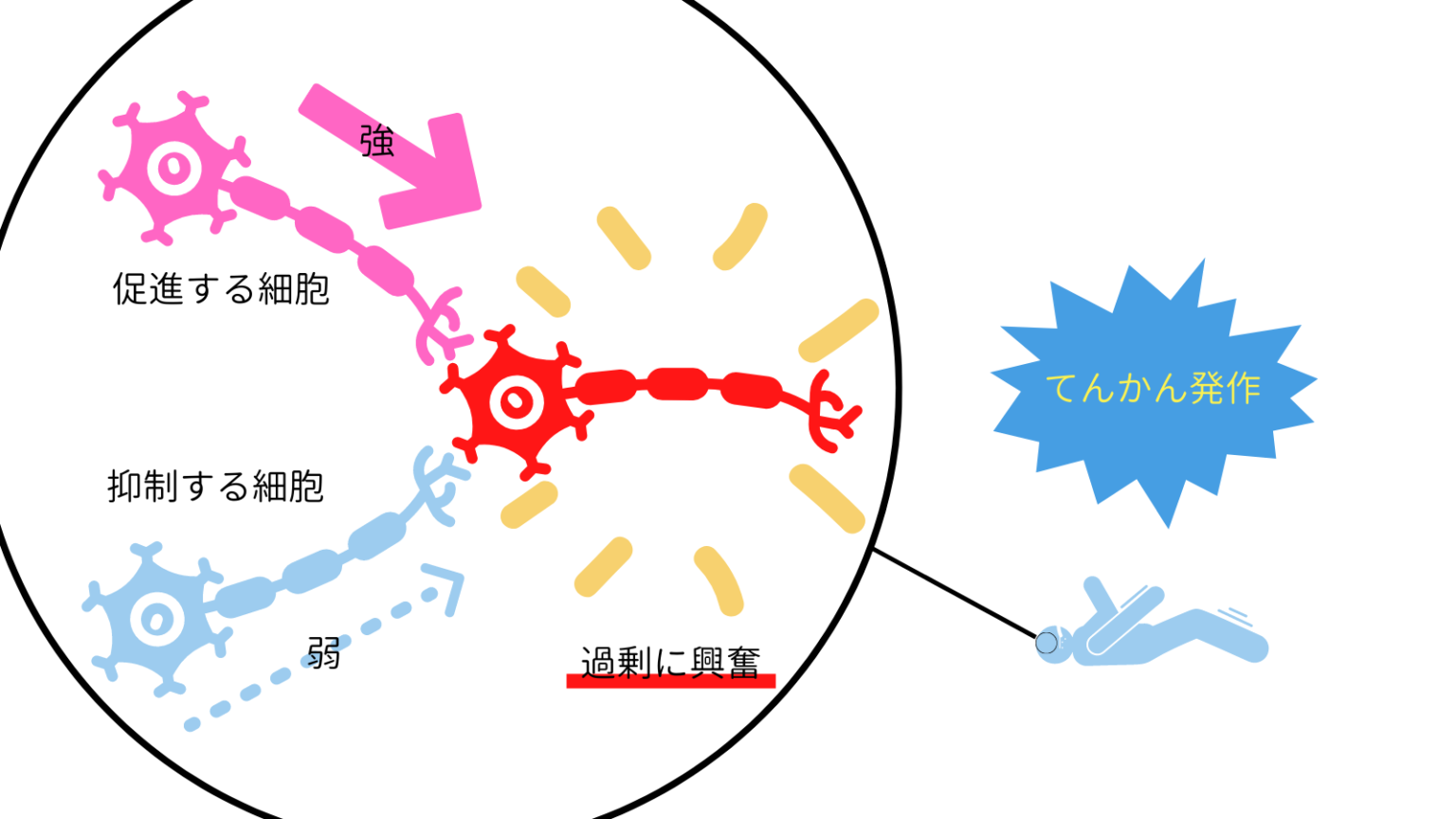 てんかんのある人との接し方や「なりやすい人」を解説!症状・原因・治療法は? - ココロジー